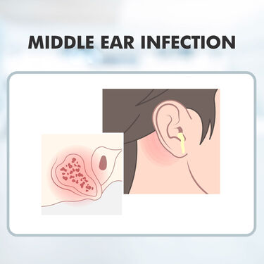 Sound Increaser for Ear (HE01)